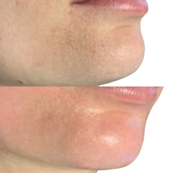 PORES BA